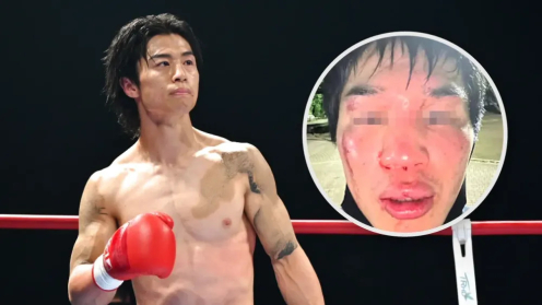 Akihiro Kaneko Under Investigation for Assault and Extortion, Allegedly "Brainwashed" Training Partner Through Violence poster